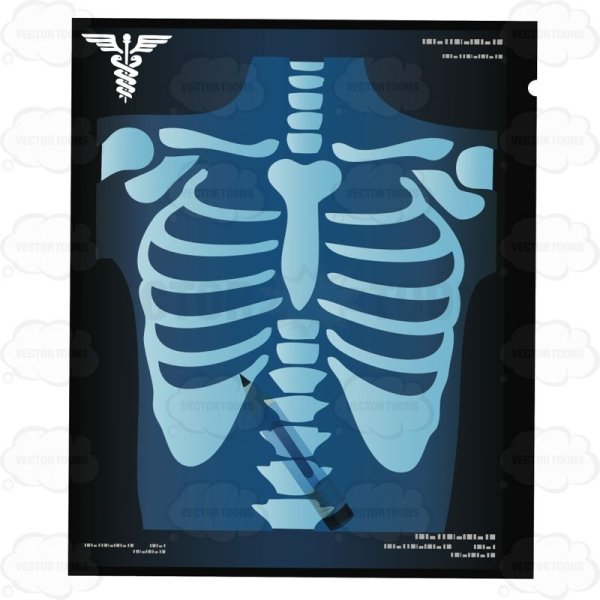 Рентгеновские снимки для детей