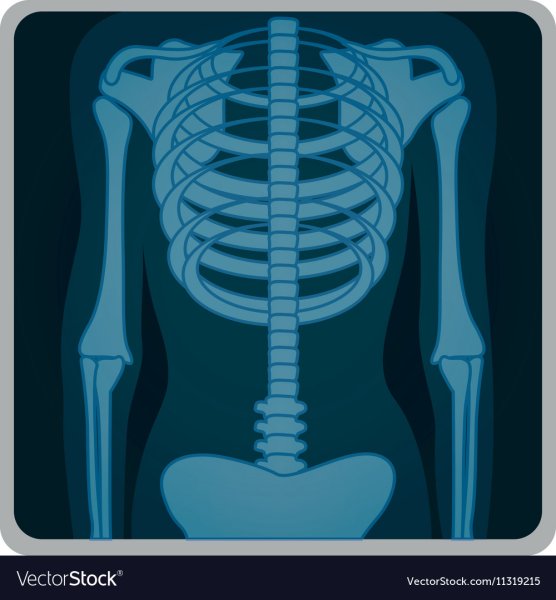 Рентген клипарт