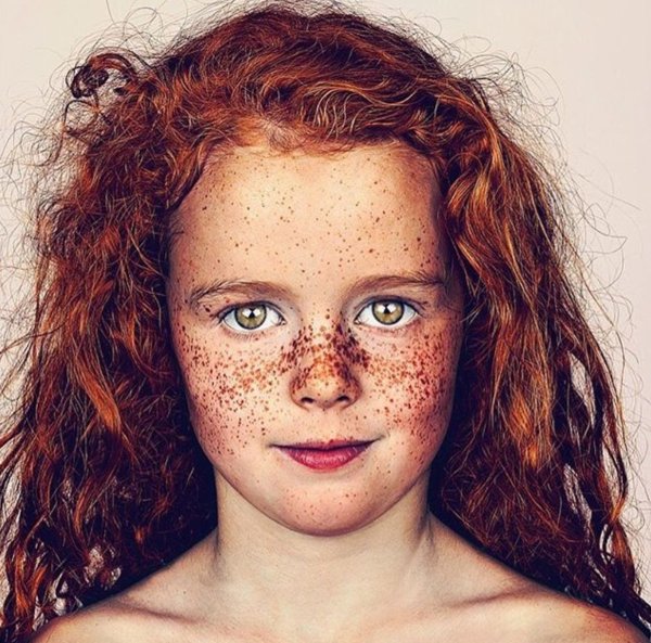 Рыжие дети с веснушками