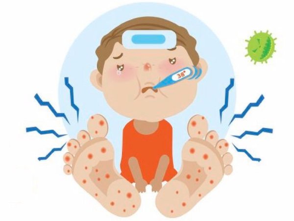 Энтеровирусный везикулярный стоматит сыпь