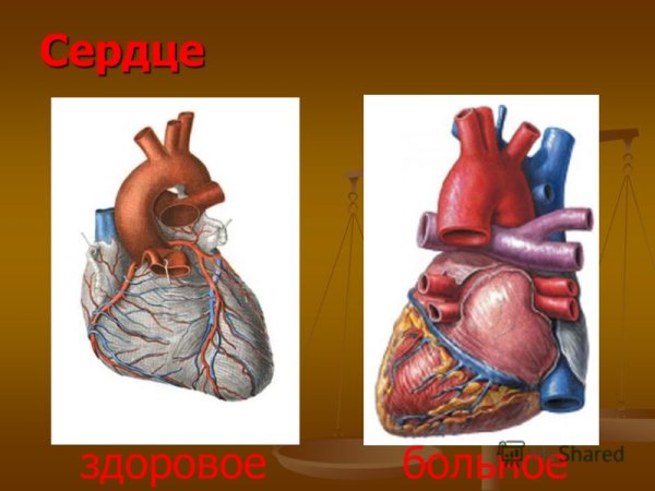Сердце здорового и курильщика