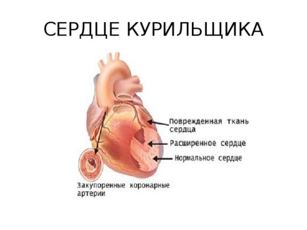 Влияние алкоголя на сердечно-сосудистую систему