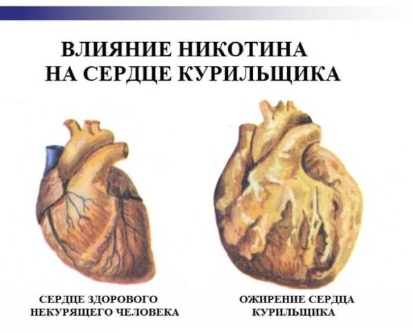 Сердце здорового человека и курящего