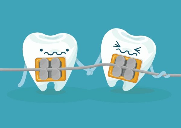 Брекеты рисунок