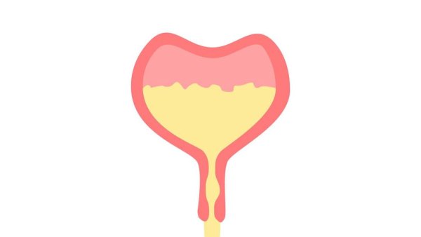 Мочевой пузырь