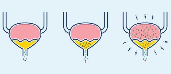 Мочевой пузырь рисунок для детей