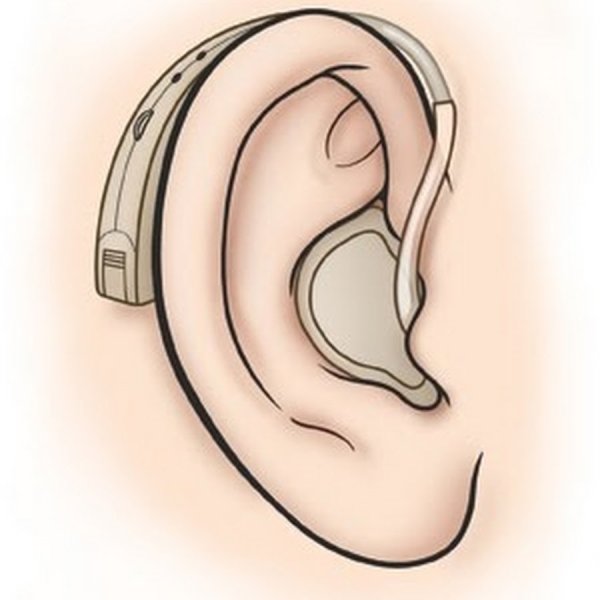 Слуховой аппарат