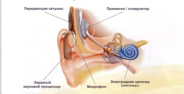 Кохлеарная имплантация строение уха