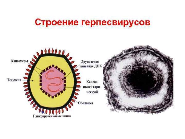 Вирус герпеса 1 типа строение
