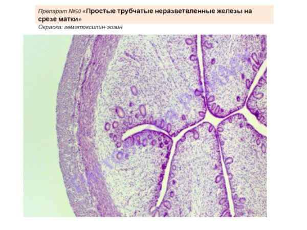 Простые трубчатые железы матки гистология