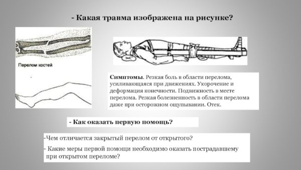 Какая травма изображена на рисунке