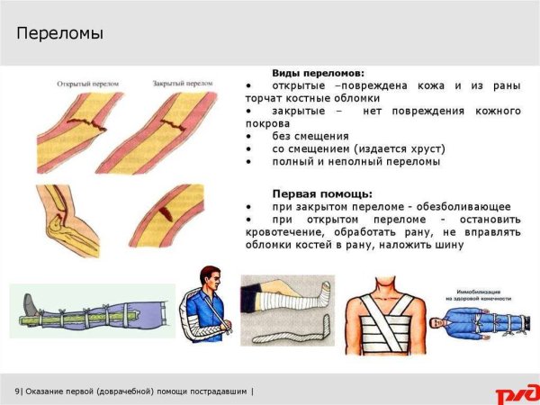 Признаки оказания первой доврачебной помощи при переломе