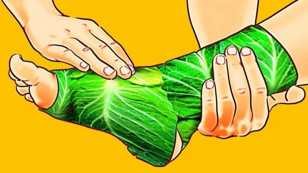 Компресс на стопу ноги капустным листом