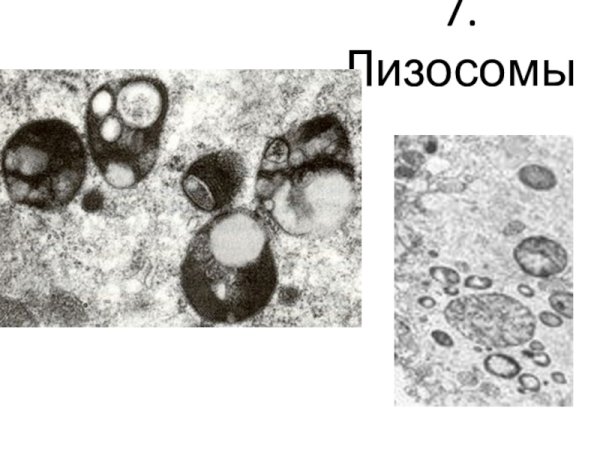 Электронограмма лизосом
