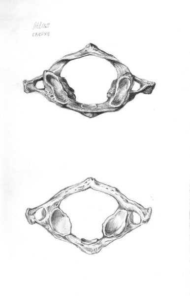 Первый шейный позвонок Атлант сверху снизу