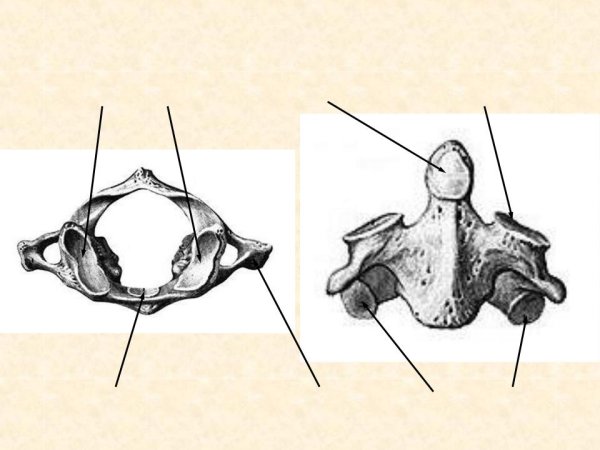 Второй шейный позвонок Атлант