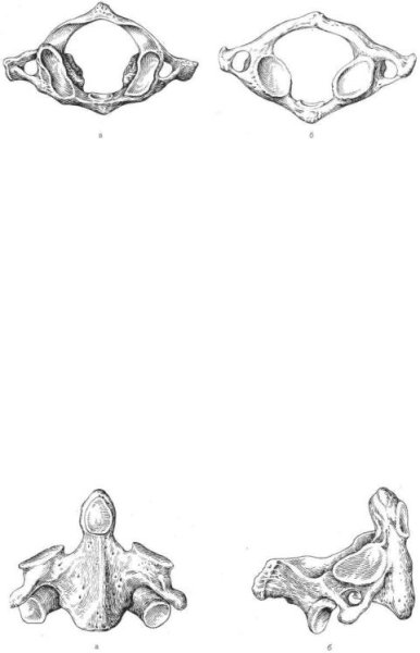 Первый шейный позвонок Атлант вид снизу