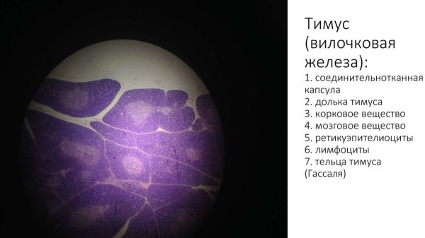 Зобная железа гистология препарат