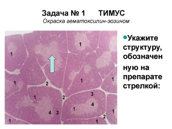 Вилочковая железа гистология препарат