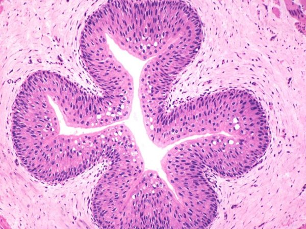 Мочеточник гистология препарат