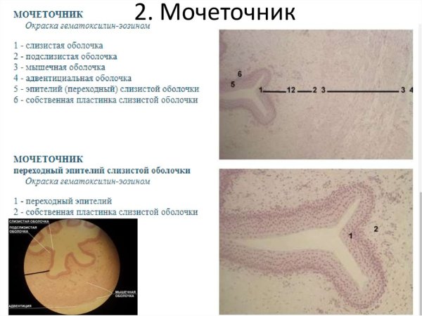 Мочеточник окраска гематоксилин-эозином