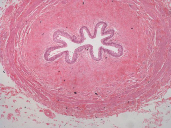 Мочеточник быка препарат гистология