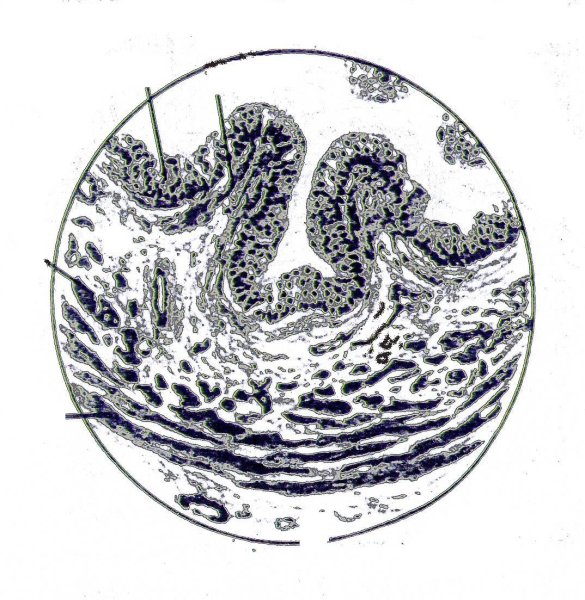 Мочеточник гистология препарат