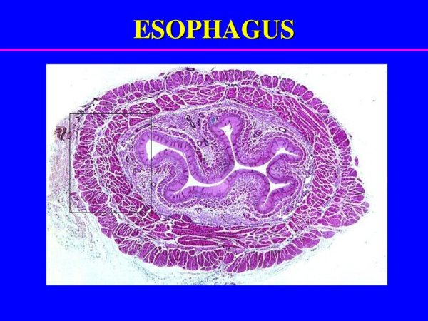 Мочеточник гистология