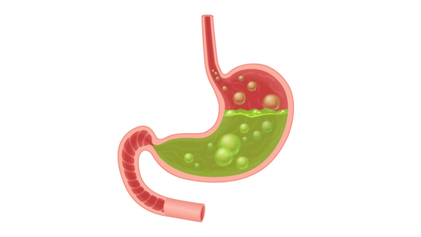 Кардиальная часть желудка анатомия