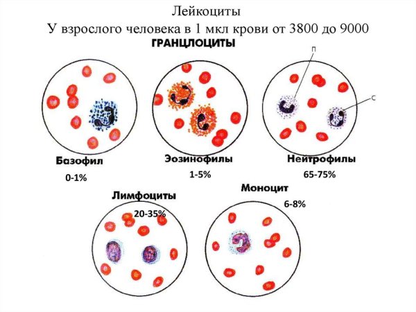 Форменные элементы крови в мокроте