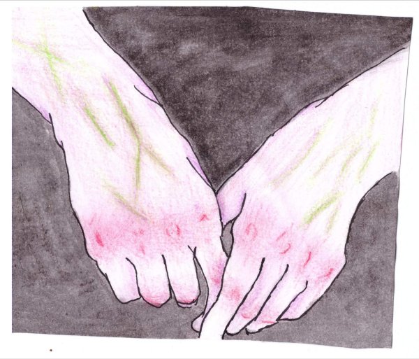 Рисование вены на руке