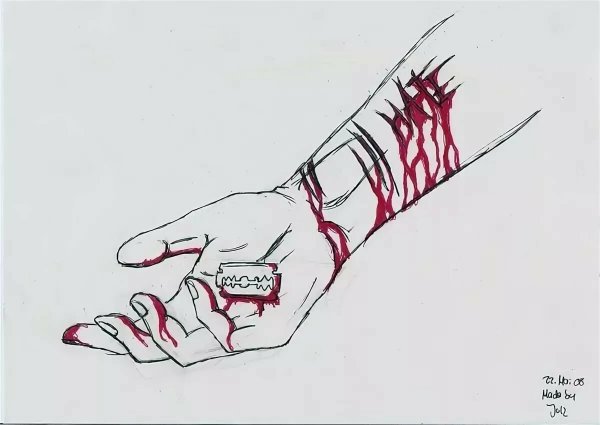 Кровеносные сосуды руки