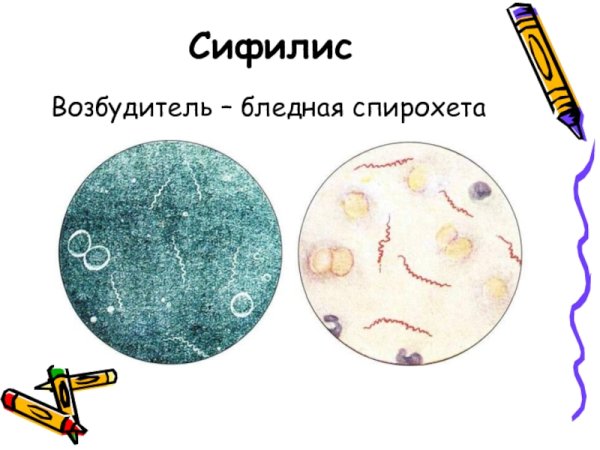 Возбудитель сифилиса микробиология