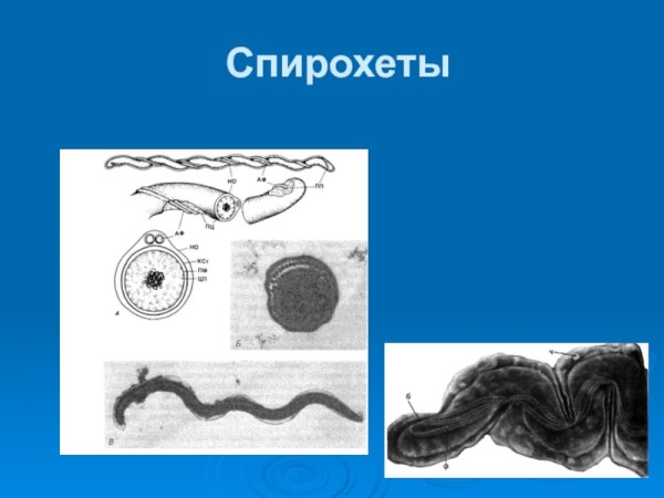 Спирохеты: морфология и ультраструктура, классификация
