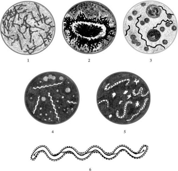 Романовский Гимзе спирохеты