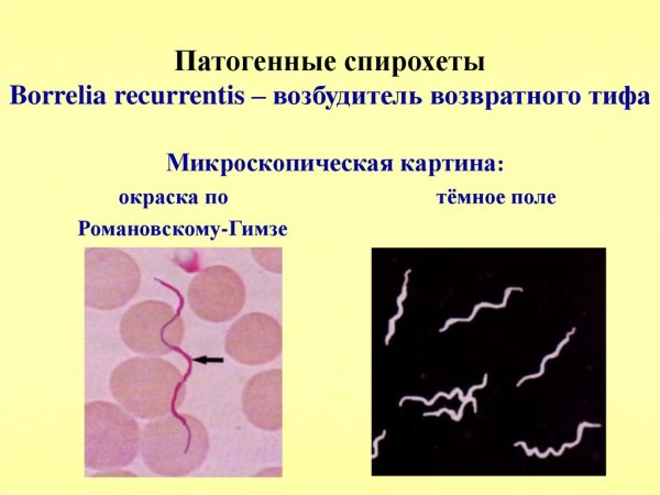 Извитые формы микроорганизмов микробиология