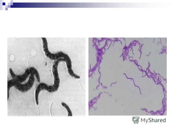 Вибрионы спириллы спирохеты