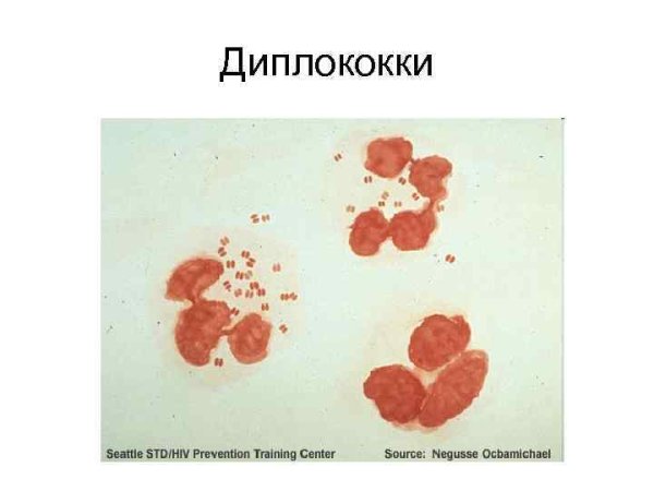 Диплококки пневмококки рисунок