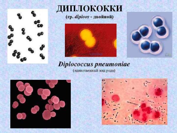 Гр- диплококки