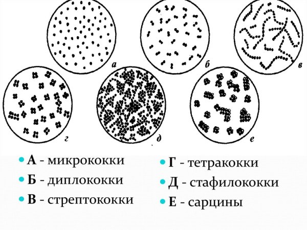 Что такое диплококки, тетракокки, стрептококки, стафилококки, сарцины