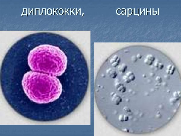 Микрококки диплококки стрептококки стрептококки стафилококки