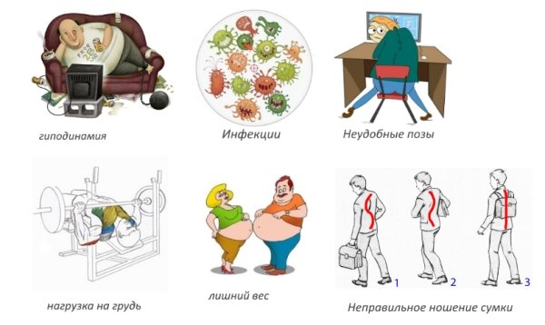 Гиподинамия недостаток двигательной активности