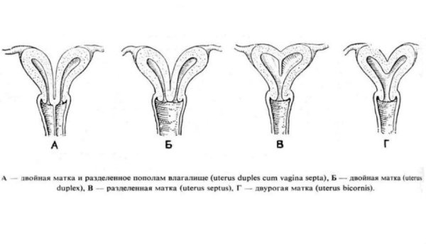 Влагалище рожавшей и нерожавшей