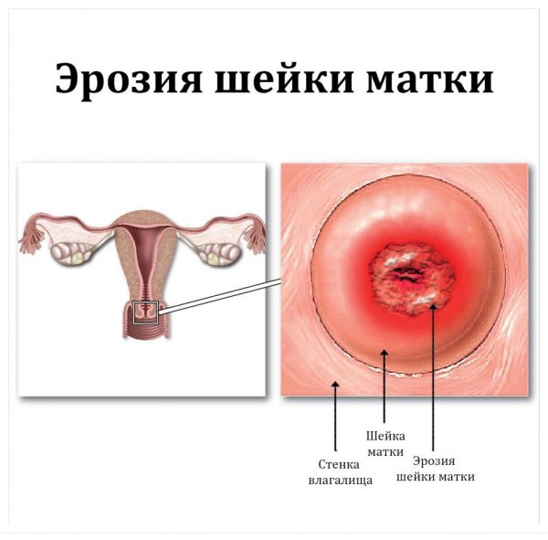 Строение матки перешеек