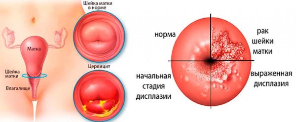Шейка матки при беременности на ощупь