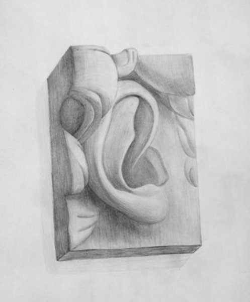 Ухо Давида гипс сбоку