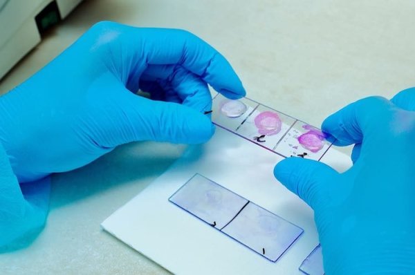 Метод висячей капли микробиология