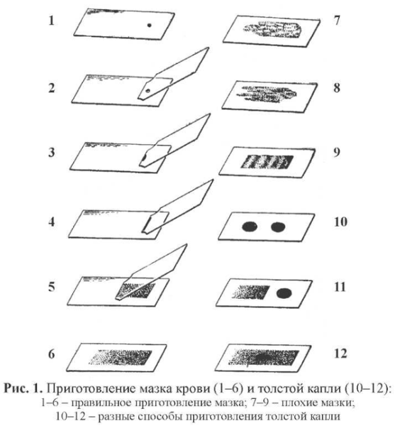 Рассматривание препарата кожицы чешуи лука