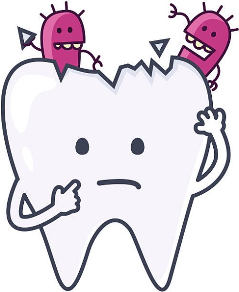 Мультяшный зуб с кариесом