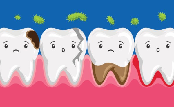 Кариозные монстры для детей